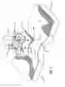 Fig. 04 - Securement device for indwelling catheters or introducers