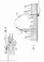 Fig. 07 - Securement device for indwelling catheters or introducers