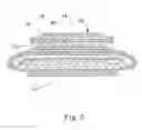 Fig. 05 - Sanitary napkin having a wipe article associated therewith