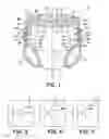 Fig. 02 - Refastenable pant-like disposable undergarment