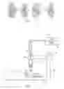 Fig. 02 - Delivery system for post-operative power adjustment of adjustable lens