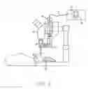 Fig. 03 - Delivery system for post-operative power adjustment of adjustable lens