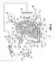 Fig. 05 - Ablation treatment of bone metastases