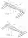 Fig. 07 - Method for spinal stabilization using a rod connector