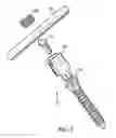 Fig. 02 - Biased angle polyaxial pedicle screw assembly