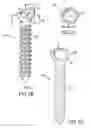Fig. 04 - Biased angle polyaxial pedicle screw assembly