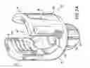 Fig. 05 - Biased angle polyaxial pedicle screw assembly