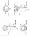 Fig. 08 - Biased angle polyaxial pedicle screw assembly