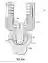 Fig. 16 - Biased angle polyaxial pedicle screw assembly