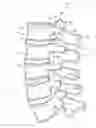 Fig. 01 - System and method for protecting neurovascular structures