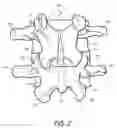Fig. 03 - System and method for protecting neurovascular structures