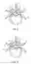 Fig. 06 - System and method for protecting neurovascular structures
