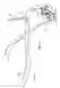 Fig. 07 - Method for installing dynamic multilock anterior cervical plate system having detachably fastened and moveable segments