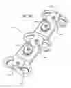 Fig. 17 - Method for installing dynamic multilock anterior cervical plate system having detachably fastened and moveable segments