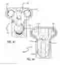 Fig. 26 - Method for installing dynamic multilock anterior cervical plate system having detachably fastened and moveable segments