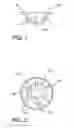 Fig. 02 - Polyaxial locking screw plate assembly