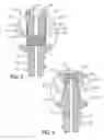 Fig. 05 - Polyaxial locking screw plate assembly