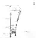 Fig. 02 - Bone shaping device for knee replacement