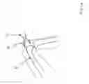 Fig. 03 - Bone shaping device for knee replacement