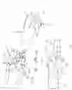 Fig. 06 - Bone shaping device for knee replacement