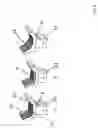 Fig. 08 - Bone shaping device for knee replacement