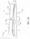 Fig. 06 - Method of preparing for an artificial intervertebral implant using tool