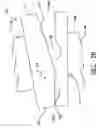 Fig. 08 - Method of preparing for an artificial intervertebral implant using tool