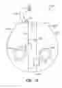 Fig. 07 - Low profile instrument immobilizer