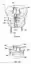 Fig. 06 - Surgical manipulator for a telerobotic system