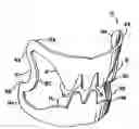 Fig. 01 - Apparatus for compressing body tissue