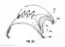 Fig. 32 - Apparatus for compressing body tissue