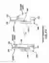 Fig. 63 - Apparatus for compressing body tissue