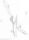 Fig. 04 - System for actuating a laparoscopic surgical instrument
