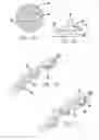 Fig. 04 - Methods and devices for reducing hollow organ volume