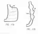 Fig. 08 - Methods and devices for reducing hollow organ volume