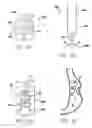Fig. 20 - Methods and devices for reducing hollow organ volume