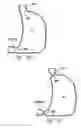 Fig. 22 - Methods and devices for reducing hollow organ volume