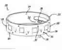 Fig. 01 - Methods and devices for reducing hollow organ volume