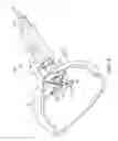 Fig. 05 - Method and apparatus for anastomosis including an anchoring sleeve