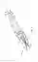 Fig. 07 - Method and apparatus for anastomosis including an anchoring sleeve