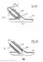Fig. 03 - Methods and devices for placing a conduit in fluid communication with a target vessel and a source of blood
