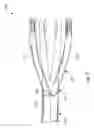 Fig. 08 - Valvulotome with a cutting edge