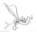 Fig. 06 - Steerable sphincterotome and methods for cannulation, papillotomy and sphincterotomy