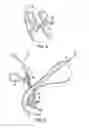 Fig. 07 - Steerable sphincterotome and methods for cannulation, papillotomy and sphincterotomy