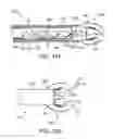 Fig. 08 - Methods and apparatus for creating and regulating a gastric stoma