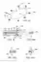Fig. 09 - Methods and apparatus for creating and regulating a gastric stoma
