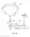 Fig. 22 - Methods and apparatus for creating and regulating a gastric stoma