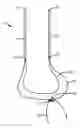 Fig. 01 - Soft tissue suspension for cosmetic surgery
