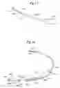 Fig. 09 - Flexible subcutaneous implantable cardioverter-defibrillator