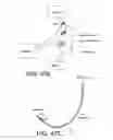 Fig. 50 - Method and system for providing therapy for bulimia/eating disorders by providing electrical pulses to vagus nerve(s)